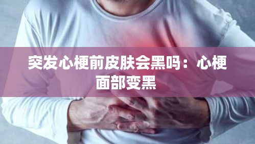 突发心梗前皮肤会黑吗：心梗面部变黑 