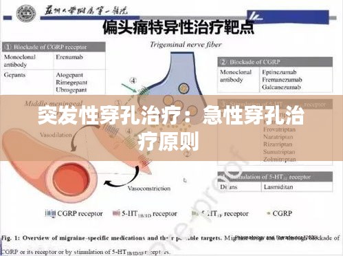 突发性穿孔治疗：急性穿孔治疗原则 