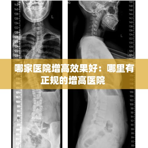 打张鸡儿 第2页