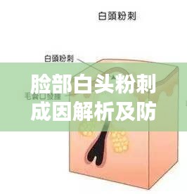 脸部白头粉刺成因解析及防治管理秘诀
