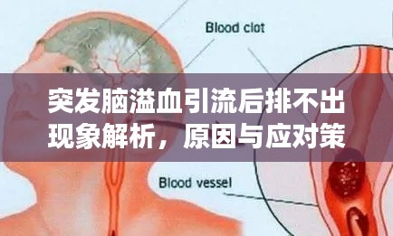 突发脑溢血引流后排不出现象解析，原因与应对策略
